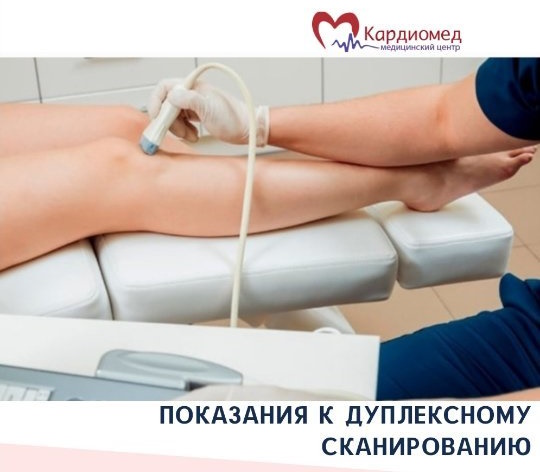 Дуплексное сканирование сосудов и вен
