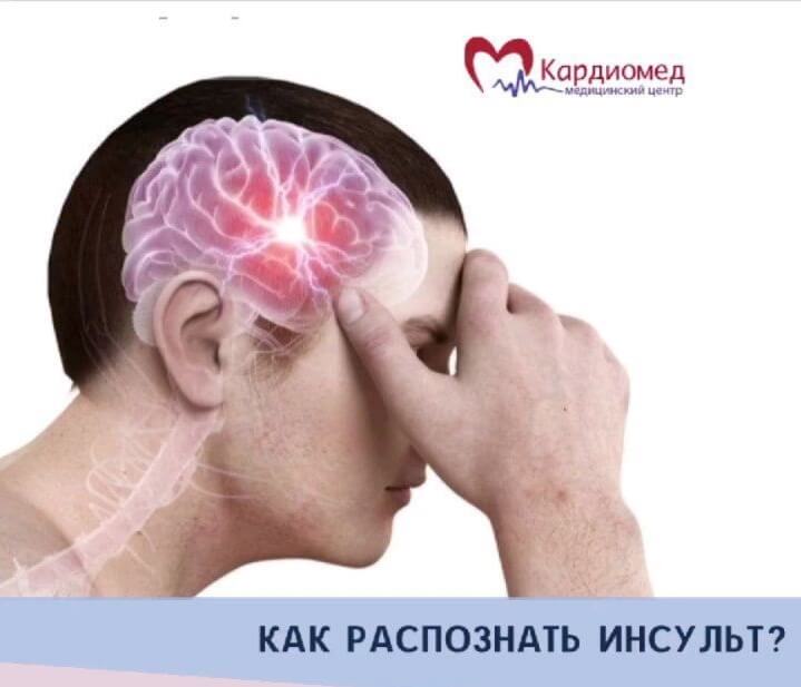 Как распознать инсульт
