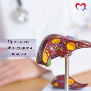Признаки заболевания печени